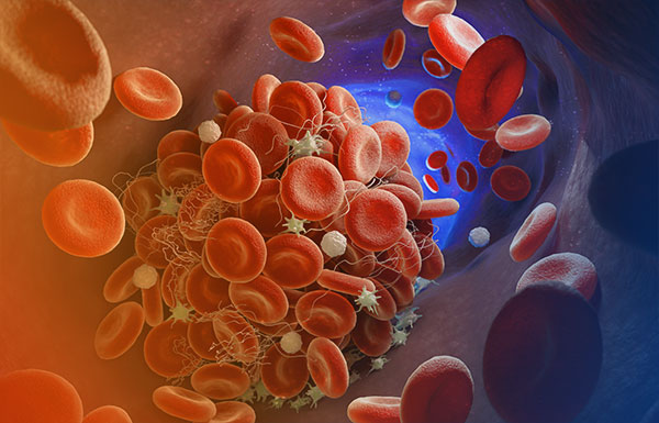 TA-TMA Transplant Associated Thrombotic MicroAngiopathy