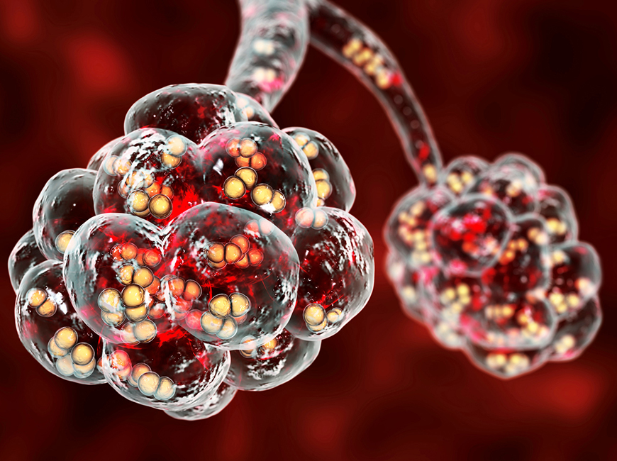 Eurofins Viracor Launches Assays for Pneumococcal Antibody Detection, Expanding Serotype Coverage to Support Immunocompromised Patient Care