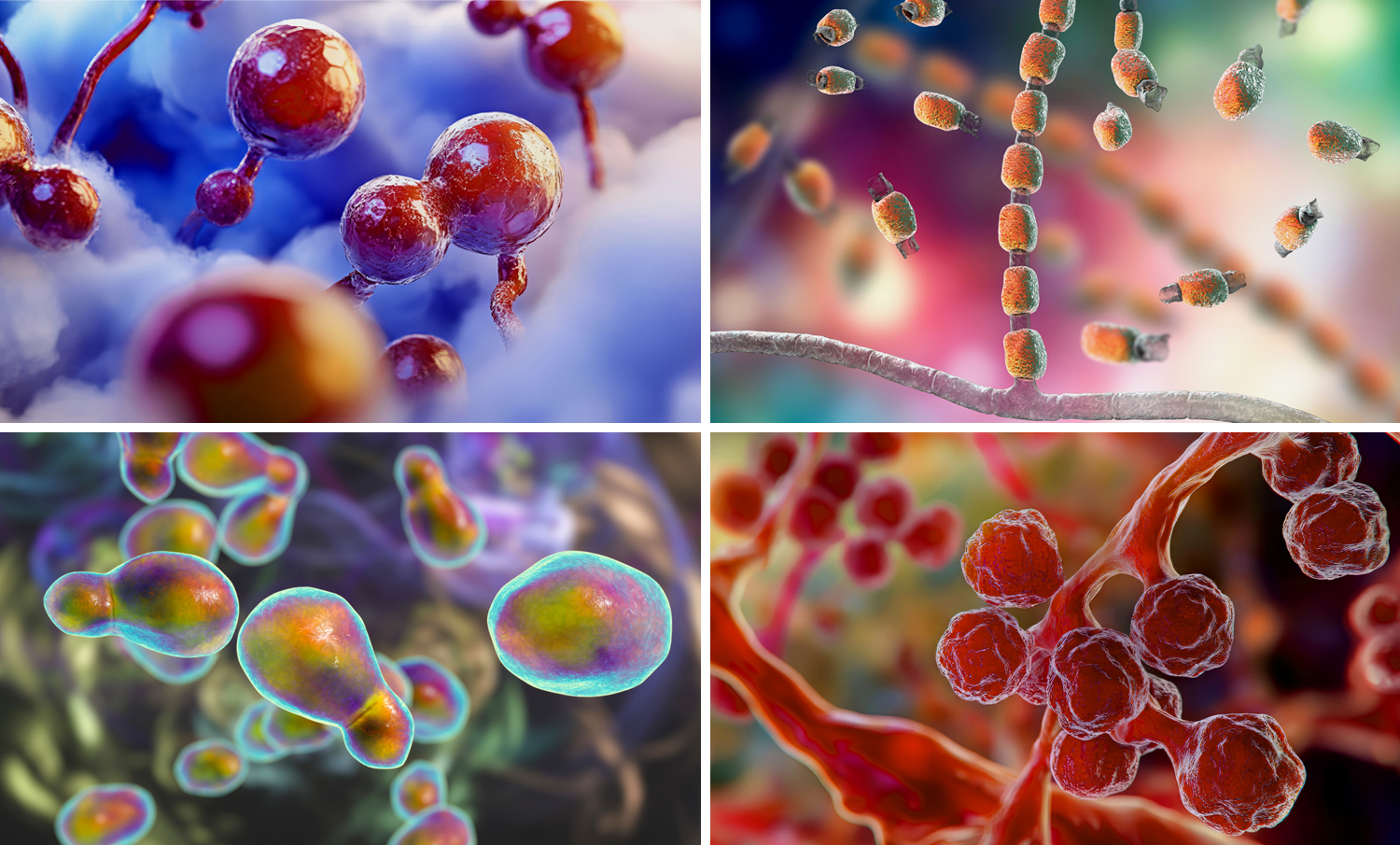 Dimorphic Fungal Infections; Blastomyces spp., Histoplasma spp., Coccidioides spp., and the pathogenic yeast Cryptococcus 